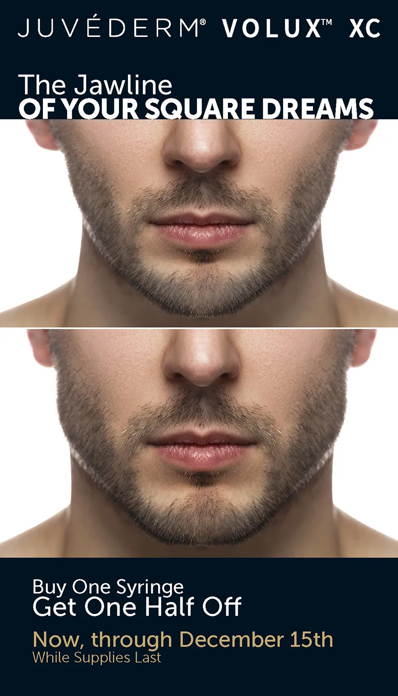 JuveDerm Volux XC in Fort Lauderdale, FL - Buy One Syringe, Get One Half Off